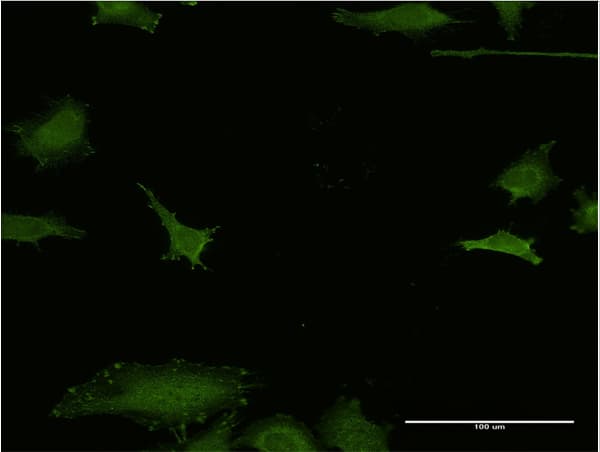 IHC-plus™ Monoclonal Mouse anti-Human EFHD1 Antibody (clone 1H7, IHC, IF, WB)