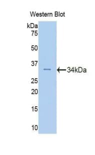 FSCN2 / Retinal Fascin Antibody (aa8-278)