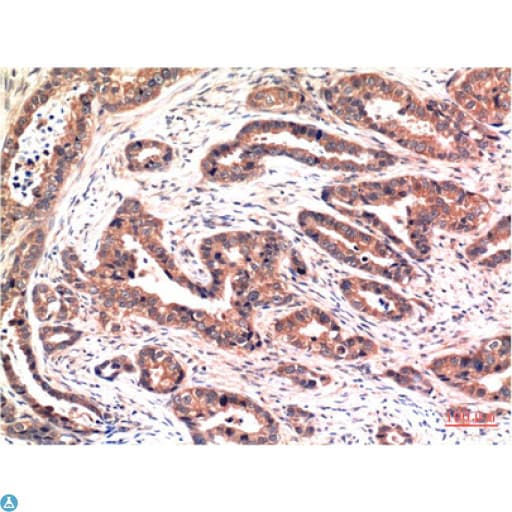 AKT1 Antibody
