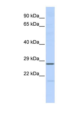 Polyclonal Rabbit anti-Human MED6 Antibody (C-Terminus, WB)