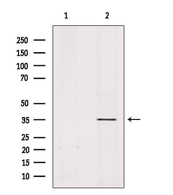 Olfactory Receptor, Family 51, Subfamily A, Member 1 Pseudogene (OR51A1P) Antibody