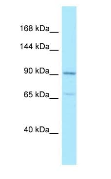 Polyclonal Rabbit anti-Human AMPD2 Antibody (aa104-153, WB)