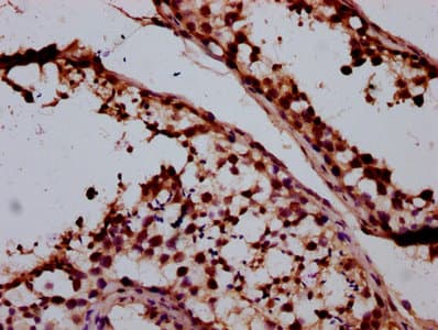 SMC1B Antibody