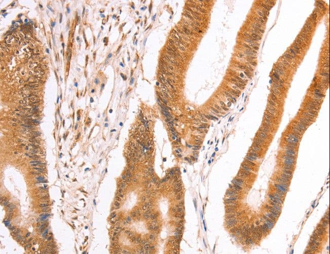 Polyclonal Rabbit anti-Human TAX1BP1 Antibody (IHC)