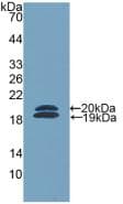 FCN2 / Ficolin-2 Antibody (aa97-254)