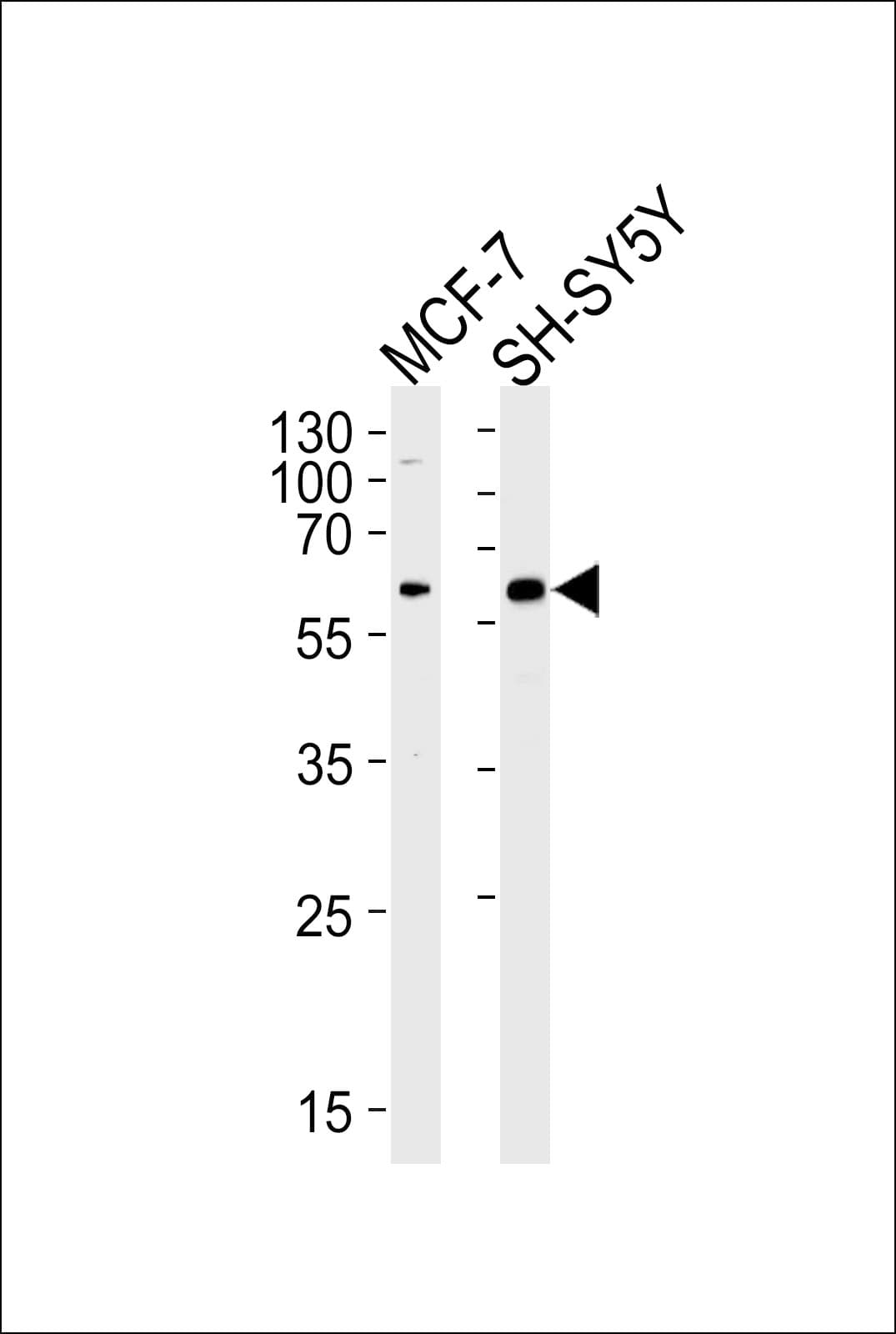 ZBTB22 Antibody (aa476-502)