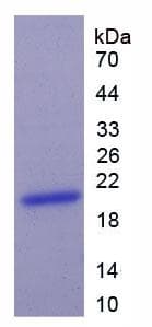 Human KRT9 / CK9 / Cytokeratin 9 Protein (Recombinant His)
