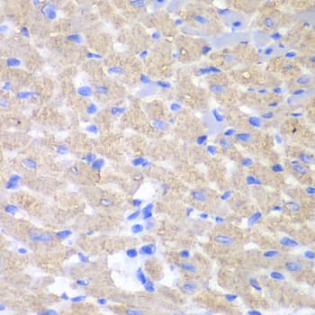 Polyclonal Rabbit anti-Human GPAM Antibody (IHC, WB)