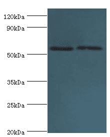 PLAP / Alkaline Phosphatase Antibody (aa260-520)