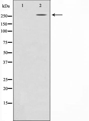 Polyclonal Rabbit anti-Human CREBBP / CREB Binding Protein Antibody (IHC, IF, WB)