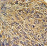 CD99L2 Antibody (aa39-66)