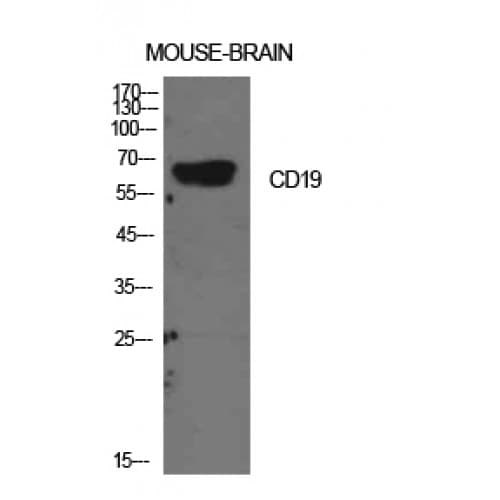 Polyclonal Rabbit anti-Human CD19 Antibody (191-240 aa, Internal, IHC, WB)