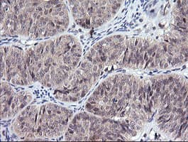 CTAG1B / NY-ESO-1 Antibody (clone OTI5A5)