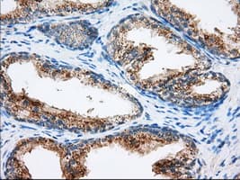 HMRF1L / MTRF1L Antibody (clone OTI2C6)