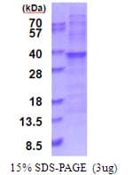 Human RPL7A / Ribosomal Protein L7a (Recombinant His)