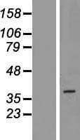 Human MPRG / PAQR5 Protein (Over-Expression Lysate Myc-DDK (Flag))