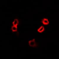 Polyclonal Rabbit anti-Human HAX-1 Antibody (IHC, IF, WB)