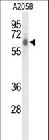 CLPTM1L / CLPTM1-Like Antibody (aa509-538)