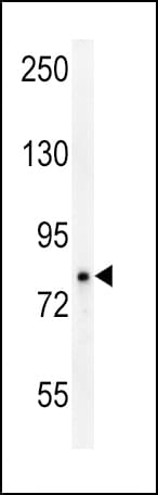 OCA2 / P protein Antibody (aa111-138)
