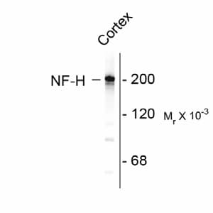 NEFH / NF-H Antibody