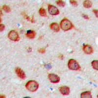 CYP2S1 Antibody (Internal)