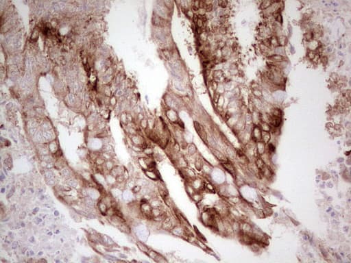 ABCB1 / MDR1 / P Glycoprotein Antibody (aa995-1280, clone OTI10H3, Carrier-free)
