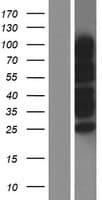Human RANBP3 Protein (Over-Expression Lysate Myc-DDK (Flag))