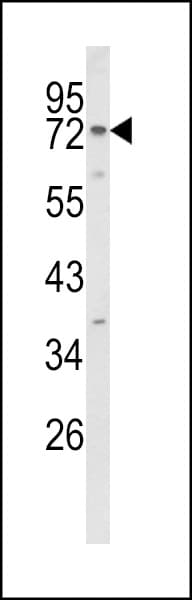 Polyclonal Rabbit anti-Human EXOC5 Antibody (aa40-66, IHC, WB)