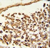 KDM4B / JMJD2B Antibody (aa4-31)