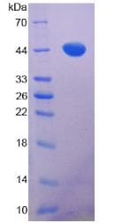 Mouse MAPT / Tau Protein (Recombinant His-T7)