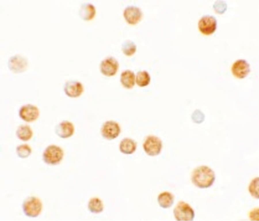 IHC-plus™ Polyclonal Rabbit anti-Human GBP6 Antibody (IHC, IF, WB)