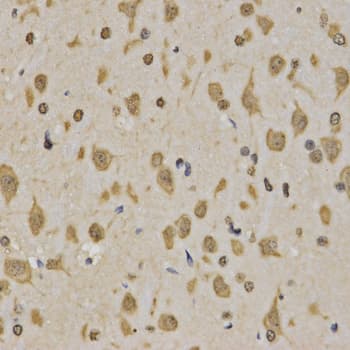 Histone H3 Antibody (Tri-Methyl-Lys4)