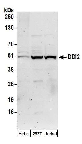 DDI2 Antibody (aa335-385)