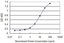 IHC-plus™ STI1 / STIP1 Antibody (clone 2E1)