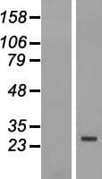 FBXO25 Protein (Over-Expression Lysate Myc-DDK (Flag))