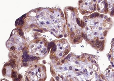 FGFR1 / FGF Receptor 1 Antibody (phospho-Tyr766)