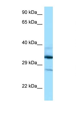 DOHH Antibody (aa63-112)