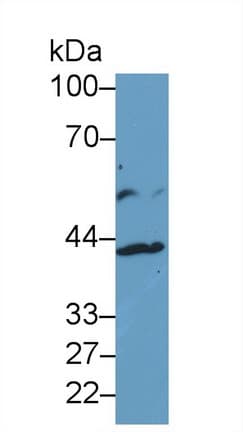 IL13RA2 / IL13R Alpha 2 Antibody (aa238-334)