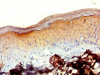 Polyclonal Rabbit anti-Human MRPL20 Antibody (aa46-149, IHC)