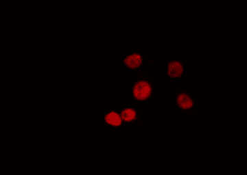 SF3B6 / SF3B14 Antibody