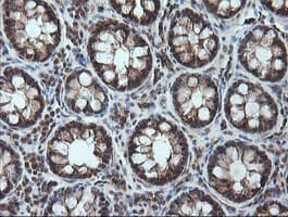 CCT8L2 Antibody (clone OTI1C1)