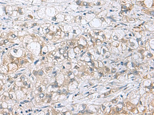 Polyclonal Rabbit anti-Human PHPT1 Antibody (IHC, WB)