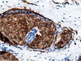 EPHX2 / Epoxide Hydrolase 2 Antibody (clone OTI1H5)