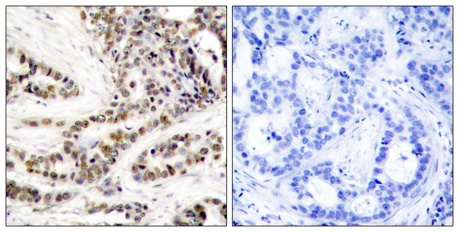 CREB1 / CREB Antibody (phospho-Ser129)