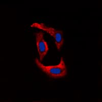 RYR2 / Ryanodine Receptor 2 Antibody (phospho-Ser2808)