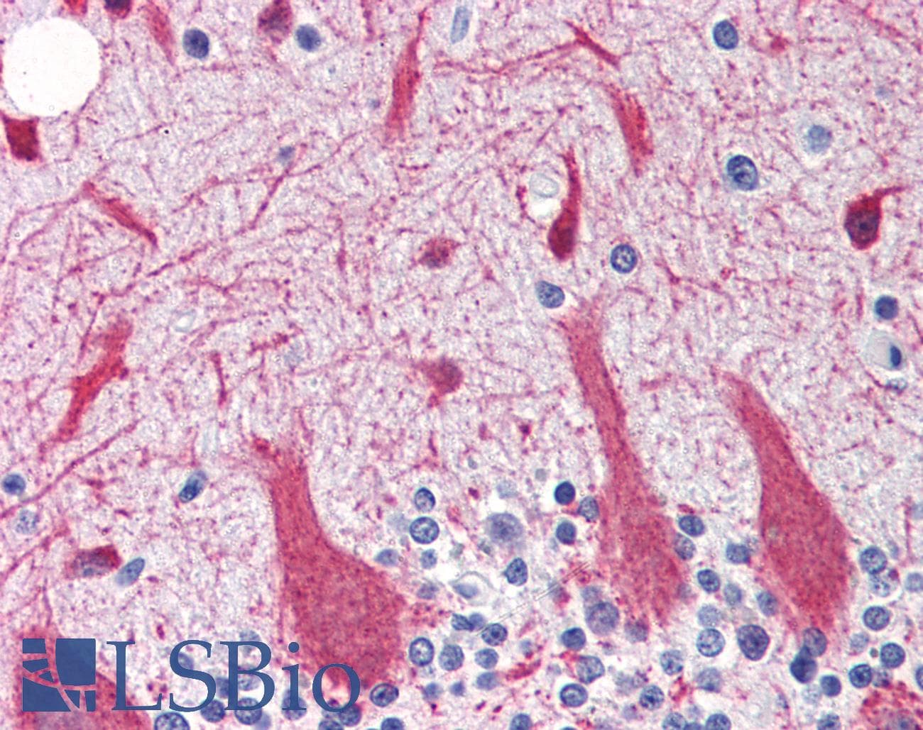 IHC-plus™ Polyclonal Rabbit anti-Human SNCG / Gamma-Synuclein Antibody (IHC, WB)