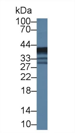 EPHX4 / Epoxide Hydrolase 4 Antibody (aa36-359)
