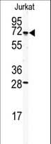 Polyclonal Rabbit anti-Human CETP Antibody (aa34-65, WB)