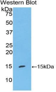 S100A7 / Psoriasin Antibody (aa1-108, Biotin)