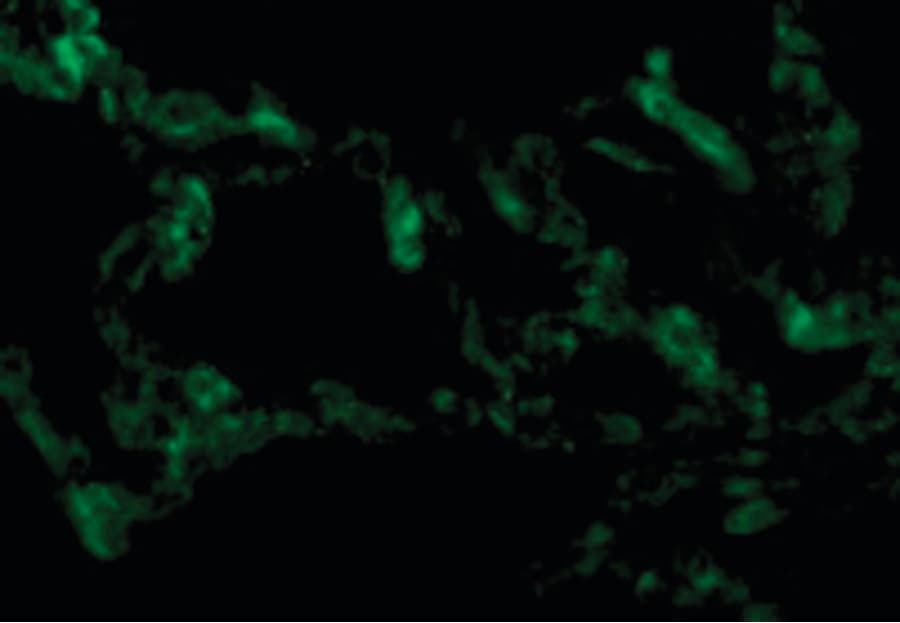 IHC-plus™ Polyclonal Rabbit anti-Human TICAM1 / TRIF Antibody (IHC, IF, WB)